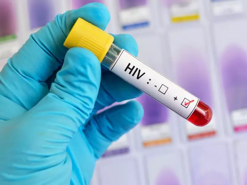 2 Pria Pemeran Video Mesum A Day in My Life Idap HIV