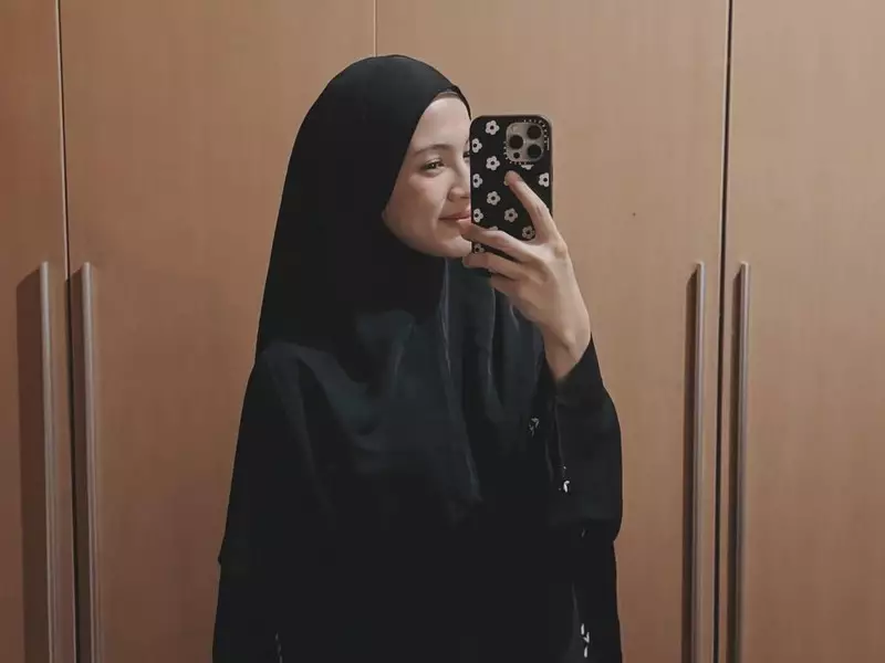 Cerita Alyssa Soebandono Jalani Operasi Skoliosis