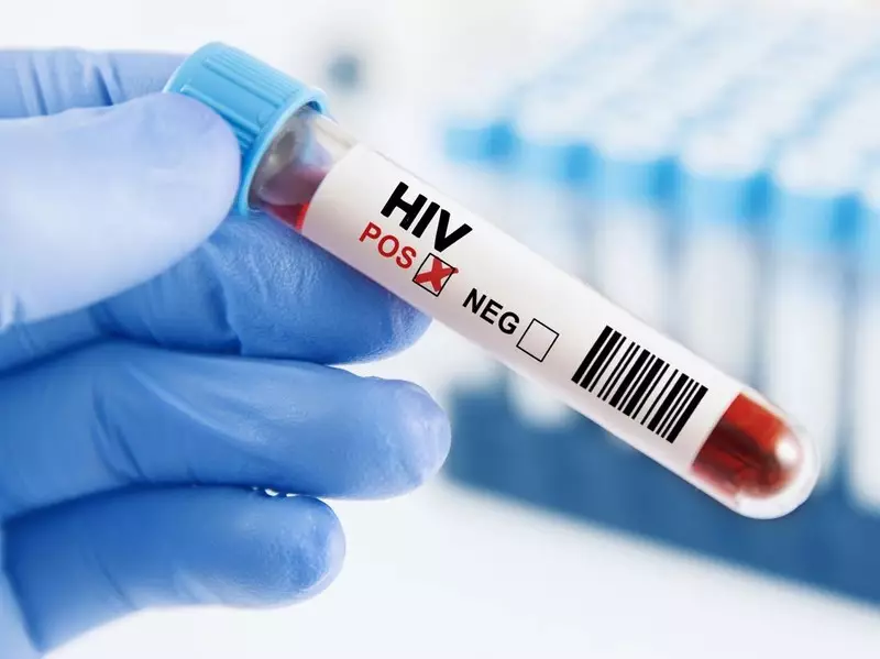 Kasus HIV/AIDS di Lebak Capai 85 Orang, 3 Penderita Meninggal