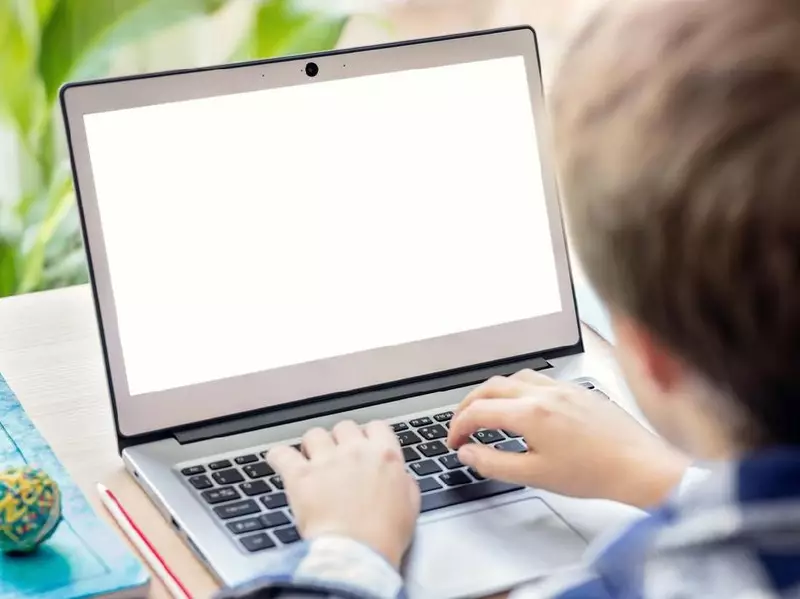 Keseringan Pakai Laptop di Pangkuan, Kulit Bocah Ini 'Gosong'